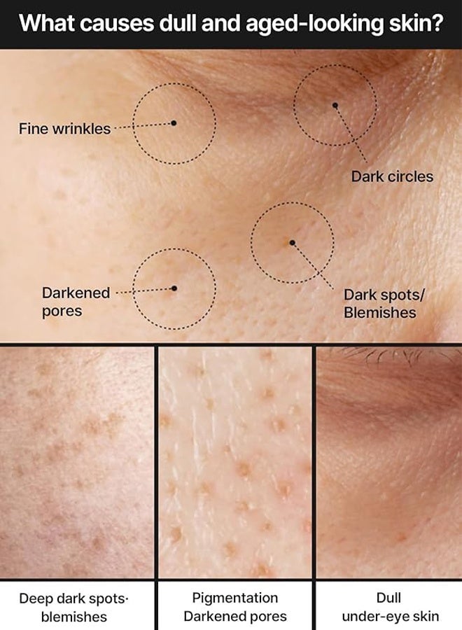 celimax Pore+Dark Spot Brightening Cream | with Niacinamide, Tranexamic Acid, TXA Cream, Pore Minimizer, Non-Irritating, Hydrating, For Sensitive Skin 35ml - Image 4